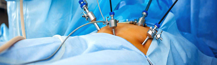 Advanced Laparoscopy & Endoscopy